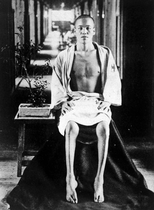 日本軍人を苦しめ続けた「脚気（かっけ）」との戦いの歴史【陸海で別れた対応】