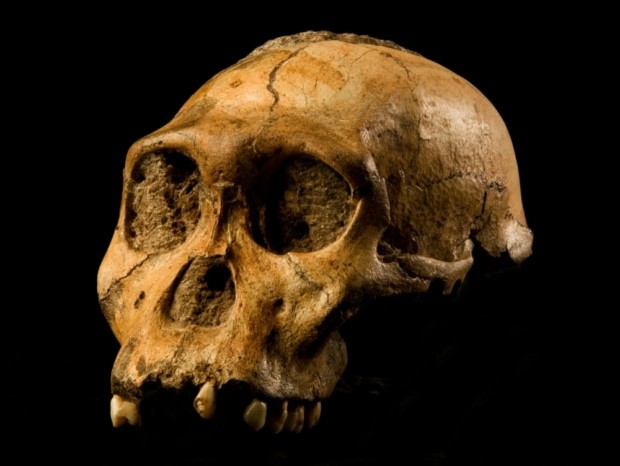 人類最古の「ガン」は170万年前だった