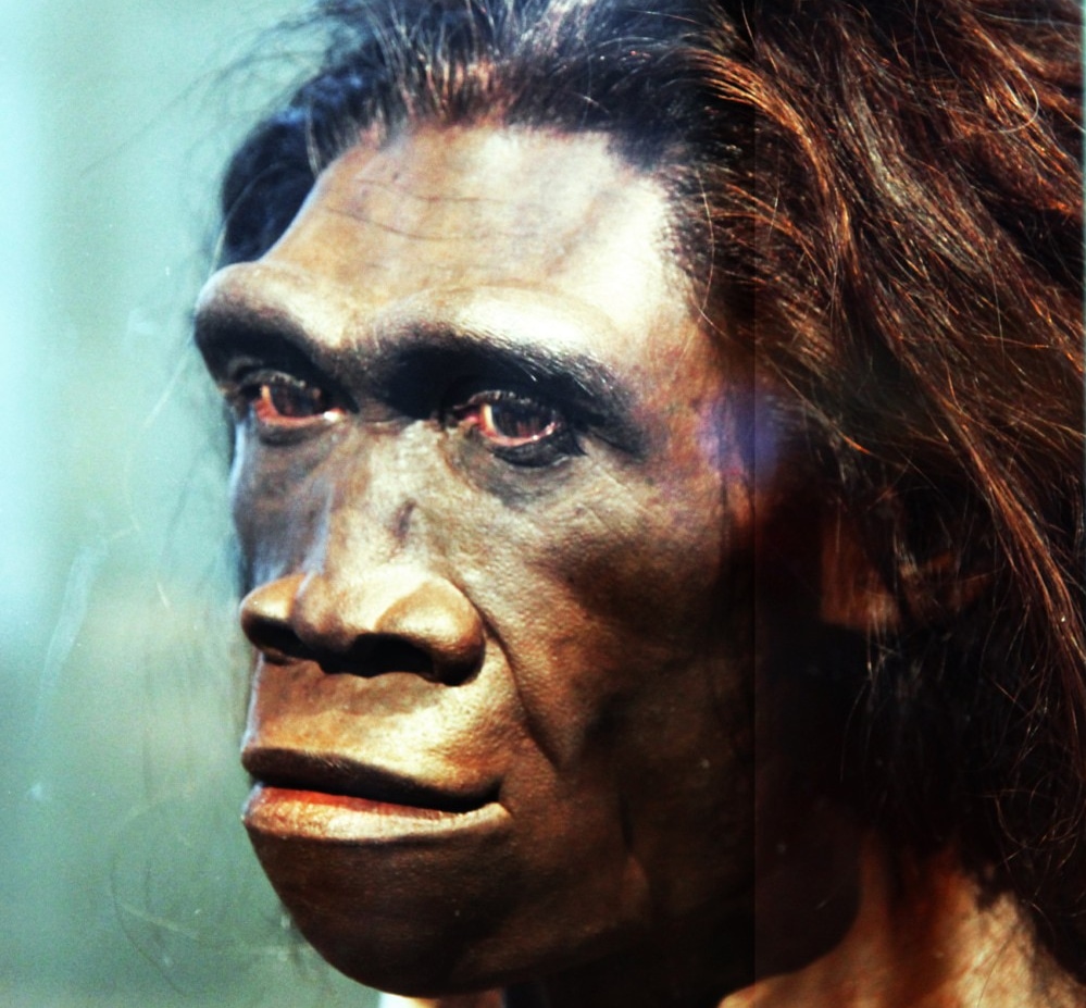 人類最古の「ガン」は170万年前のホモ・サピエンス以前の種の骨肉腫だった
