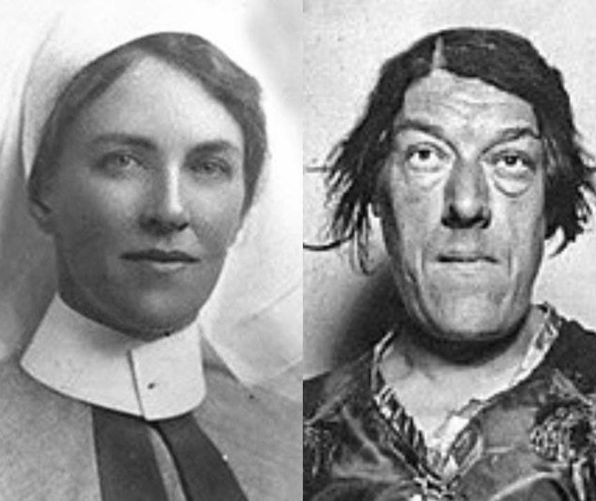 美人看護師だったメアリーが「世界一醜い女性」となった理由とは