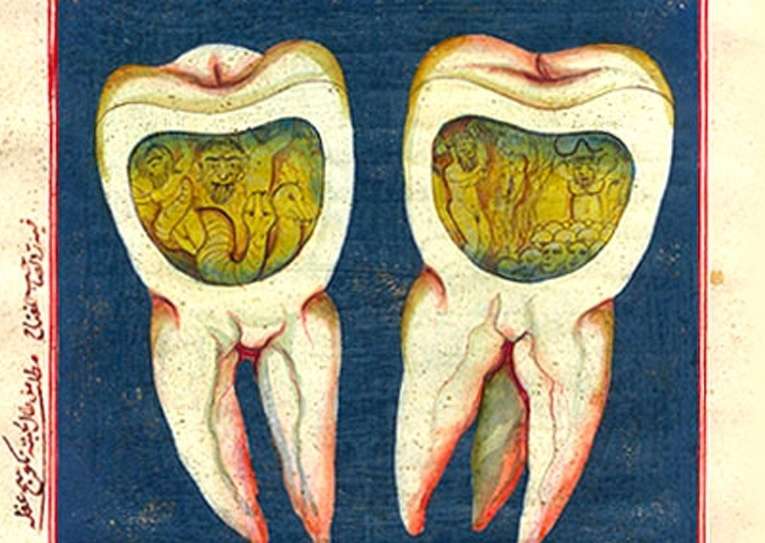 「虫歯は“神が許した虫”だった？」知られざる古代の虫歯伝説